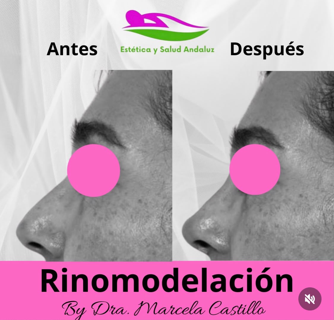 Después